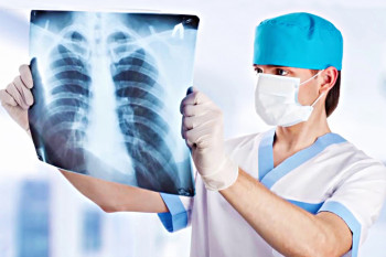 În Republica Moldova vor fi implementate noi tehnologii de diagnostic al tuberculozei