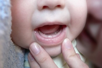 Reacțiile bebelușilor la ieșirea dinților