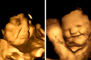 Bebelușii pot avea gust și miros în uter. Studiu: cum reacționează bebelușii nenăscuți la aromele alimentelor consumate de mamele lor.