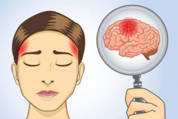 Nu ignora niciodată cele 6 simptome ale unui accident vascular cerebral