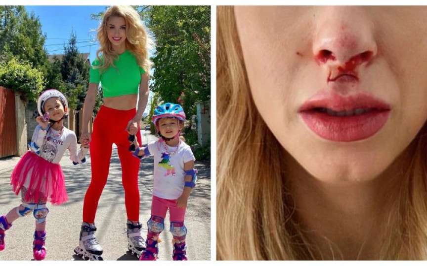 Andreea Bălan a ajuns de urgență la spital: „Doctorul mi-a cusut buza de sus”