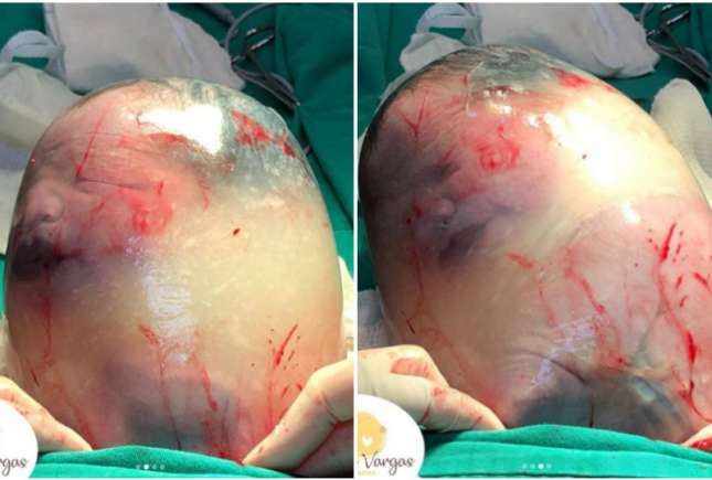Importanța lichidului amniotic în evoluția sarcinii. Când trebuie să ne îngrijorăm?
