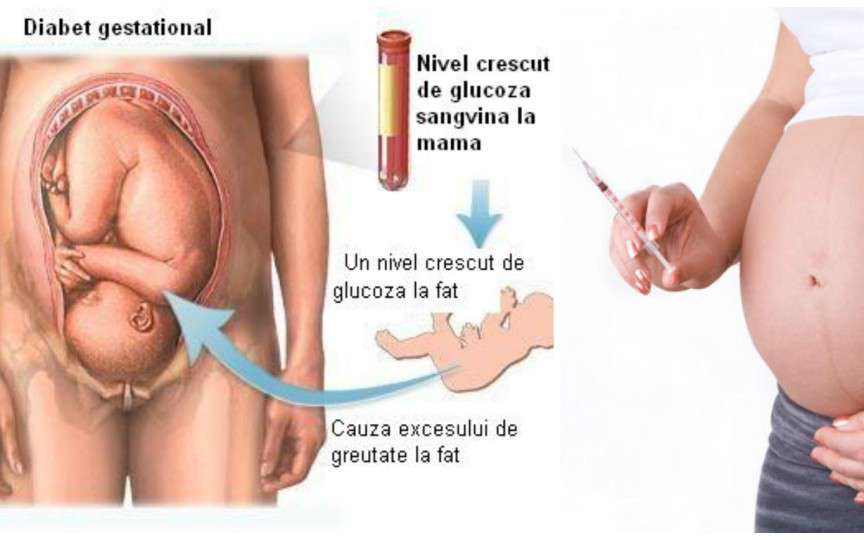 Tot ce trebuie să știi despre diabetul de sarcină (gestațional)