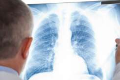 Screening pulmonar gratuit în raionul Călărași – consultații profilactice pentru toți locuitorii