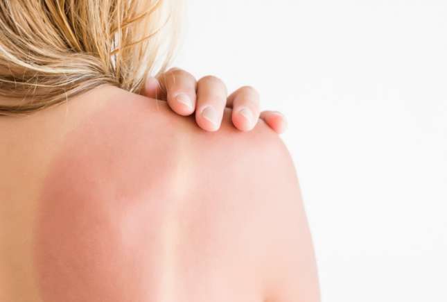 Medic dermatolog despre cum poate fi prevenit cancerul de piele