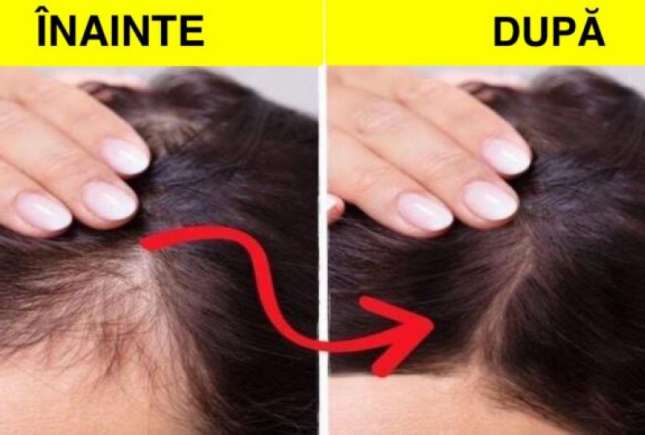 10 Remedii naturale și eficiente pentru a-ți reface și întări rapid părul