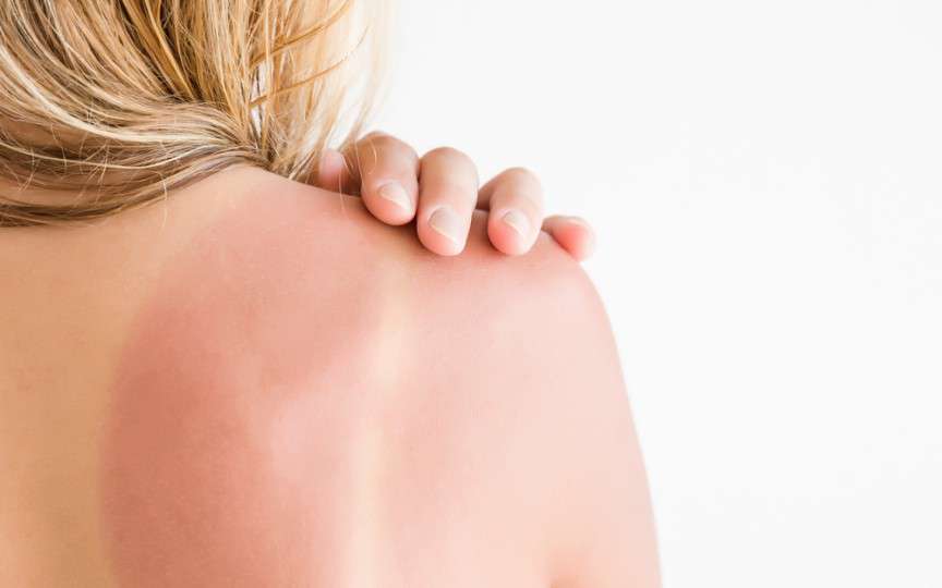 Medic dermatolog despre cum poate fi prevenit cancerul de piele