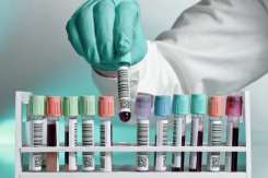 Analizele medicale ce trebuie făcute o dată pe an pentru a te asigura că nu ai probleme de sănătate