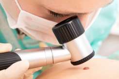 Medic dermatolog: Regulile după care distingem o aluniță periculoasă