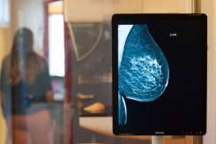 Mamografia – o necesitate. Vezi unde găsești la noi unicul utilaj de ultimă generație pentru mamografie!