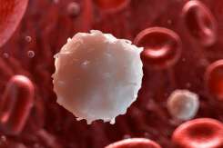 Medic hematolog: Febra, sângerările din nas, ameţeala - pot fi semne ale leucemiei