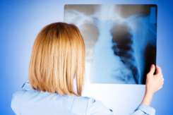 Pneumonia, netratată, poate duce la deces: simptome, cauze și factori de risc