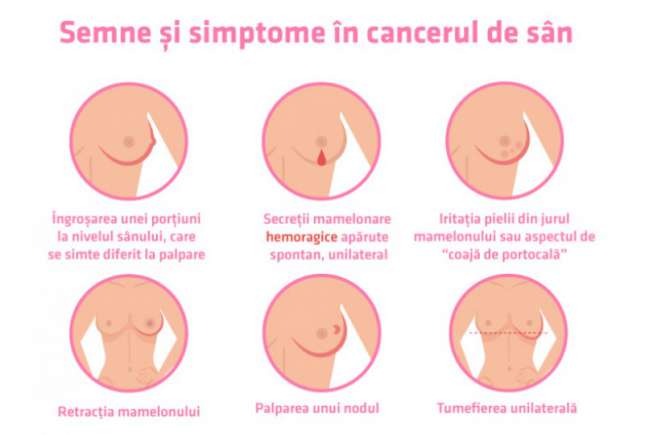 Medic oncolog: Durerea de sân le sperie pe femei, însă cel mai frecvent semn al cancerului mamar este altul