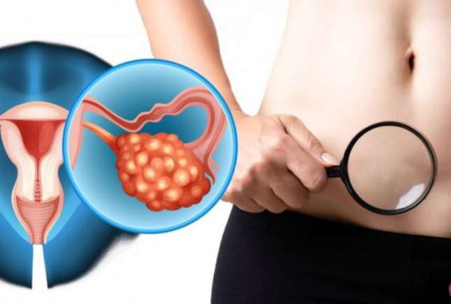 4 Simptome ale cancerului ovarian pe care fiecare femeie trebuie să le cunoască