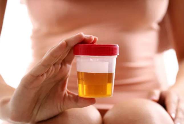 Ce spune culoarea urinei despre sănătatea ta: Ghid complet pentru a interpreta semnele