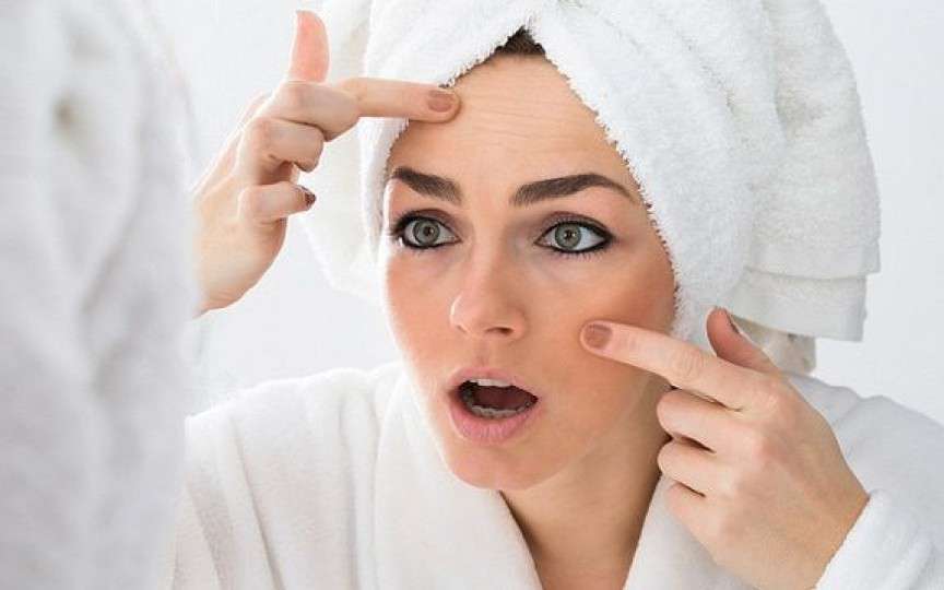 Este dermatita seboreică o problemă medicală cu care se poate trăi?