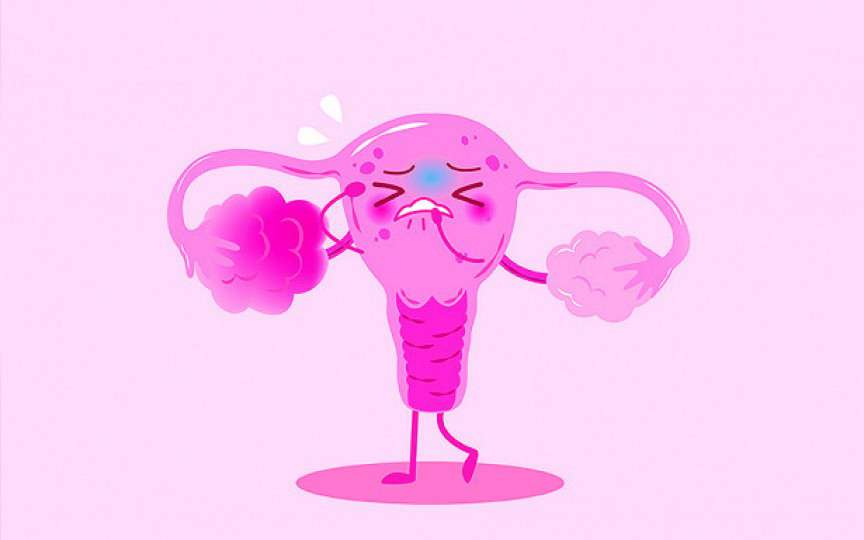 Chist ovarian - factori de risc, simptome, diagnostic și tratament