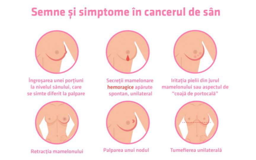 Medic oncolog: Durerea de sân le sperie pe femei, însă cel mai frecvent semn al cancerului mamar este altul