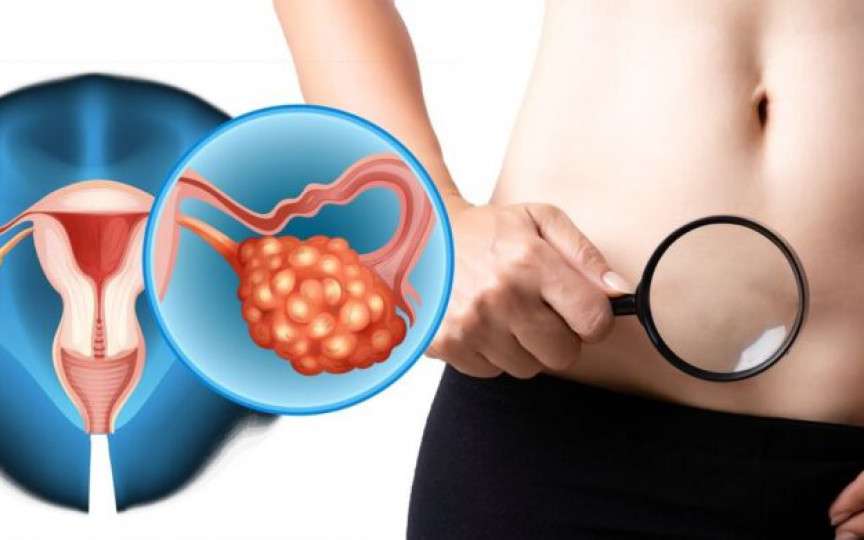 4 Simptome ale cancerului ovarian pe care fiecare femeie trebuie să le cunoască