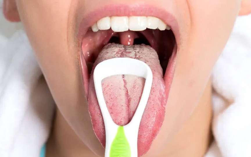 Sindromul gurii care arde – ce este, de ce apare la menopauză și cum poate fi tratat
