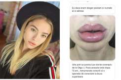 Bloggerița Gabriella Damir a dezvăluit că zeci de moldovence au fost desfigurate la un salon de frumusețe din capitală