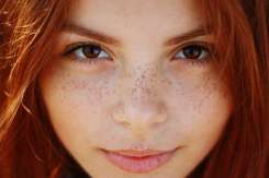 Pistruii  - complex sau mândrie? Află de la cosmetologa Natalia Spătaru cauza apariției lor și cum pot fi camuflați