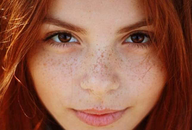 Pistruii  - complex sau mândrie? Află de la cosmetologa Natalia Spătaru cauza apariției lor și cum pot fi camuflați