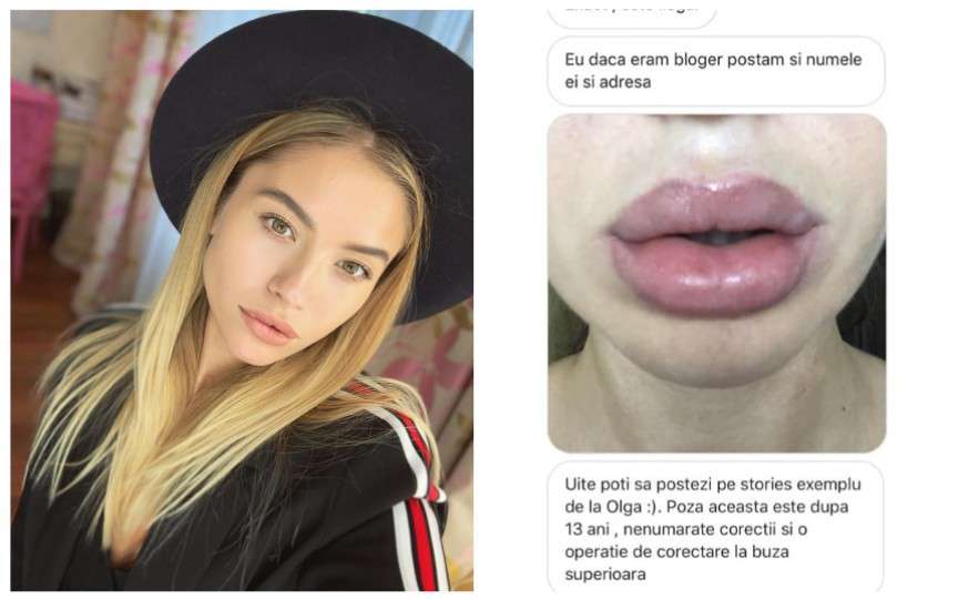 Bloggerița Gabriella Damir a dezvăluit că zeci de moldovence au fost desfigurate la un salon de frumusețe din capitală