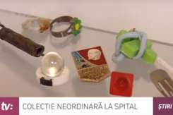 Colecție curioasă la Institutul Mamei și Copilului: obiecte înghițite de copii