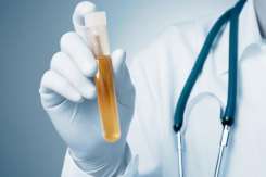 Medicul pediatru, Dorina Agachi, explică ce înseamnă leucocite în urină