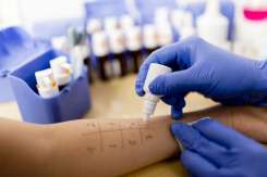 TOP 7 alimente care provoacă alergii la copii