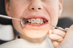 Legătura dintre alinierea dentară și postura corpului la copii