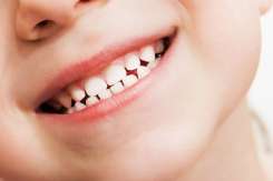 Îngrijirea dinților de lapte: Ce trebuie să știi despre igiena orală la bebeluși și prevenirea cariilor