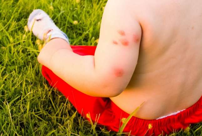 10 cele mai comune alergii la copii, vara
