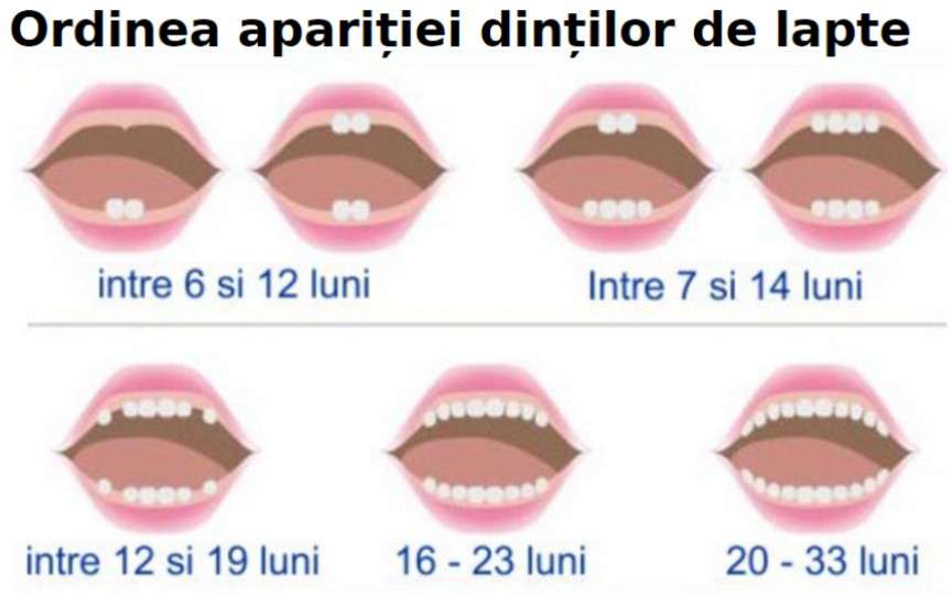 Medic stomatolog: 10 mituri și adevăruri despre îngrijirea dinților de lapte