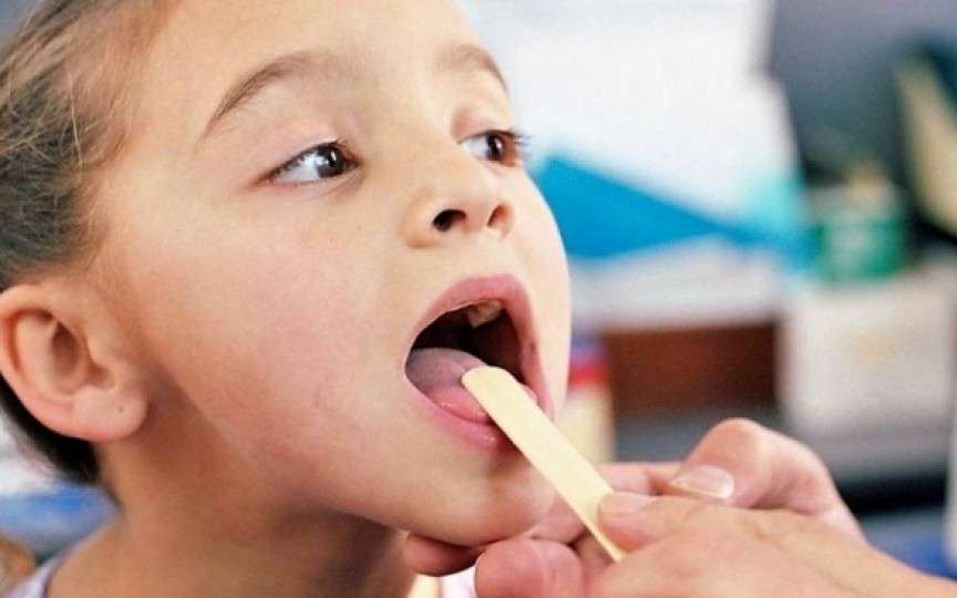 Limba zmeurie, un simptom care apare în bolile acute la copii