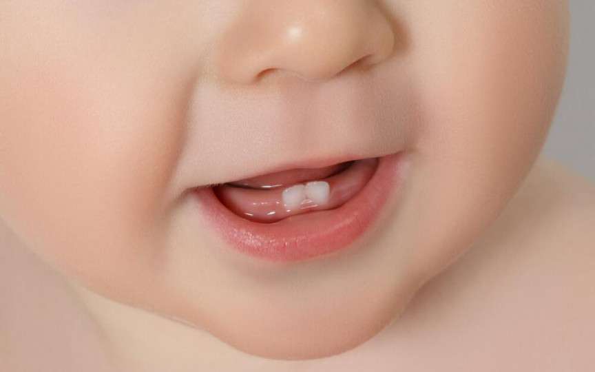 Ce strică smalțul dinților la copii și cum poate fi întărit