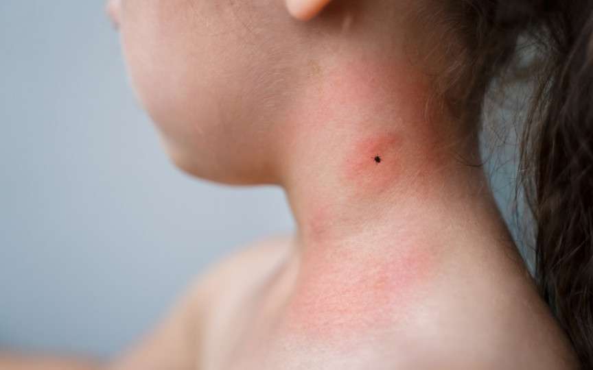 A venit vara! Cum ne protejăm copiii de căpușe. Cele 4 sfaturi de care să ții cont