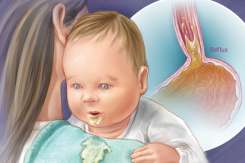 Medic pediatru: 99% dintre colegii mei pun prea ușor diagnosticul de reflux la bebeluși, iar medicamentele sunt riscante