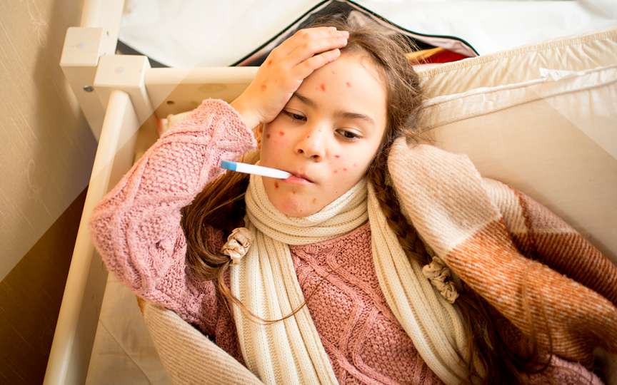 Știați că verdele de briliant nu tratează varicela? Iată care este utilitatea lui în cazul bolii