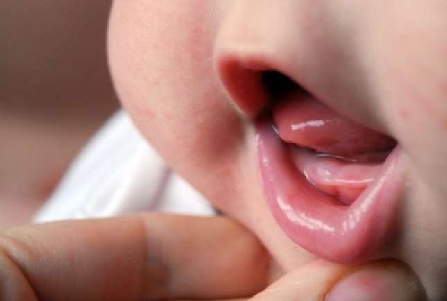 7 semne că apar primii dinţişori la bebeluș