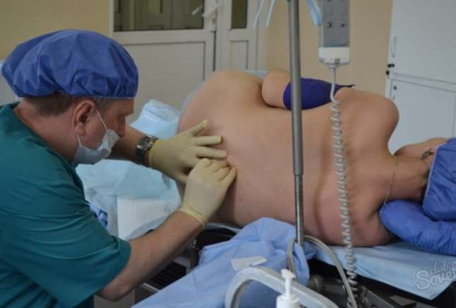 Anestezia epidurală – tot ce trebuie să știe o femeie care dorește să o folosească
