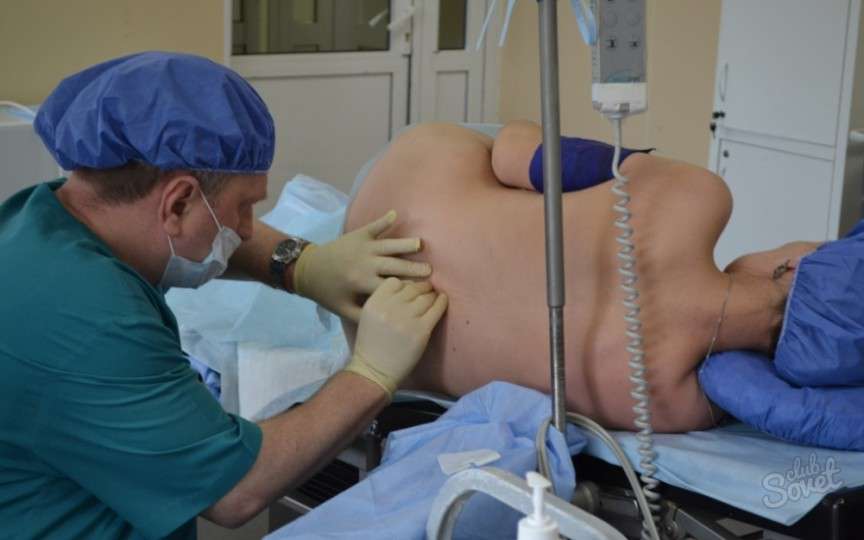 Anestezia epidurală – tot ce trebuie să știe o femeie care dorește să o folosească