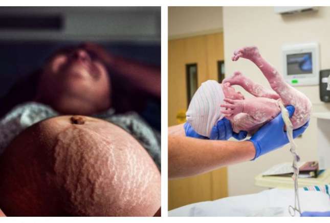 Imagini emoționante din cadrul concursului fotografilor de naștere profesioniști
