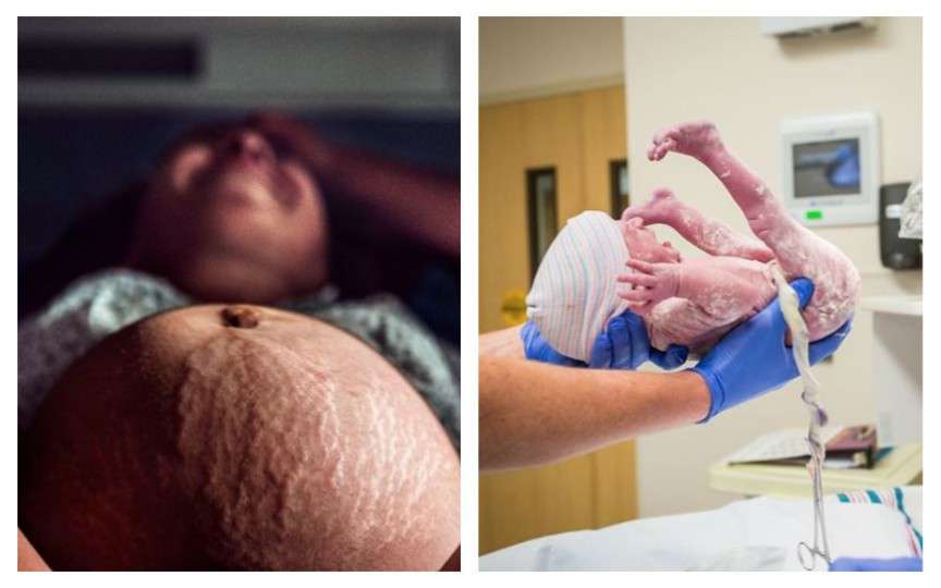 Imagini emoționante din cadrul concursului fotografilor de naștere profesioniști