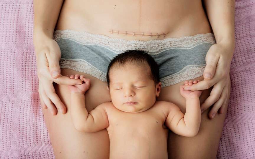 Recuperarea după cezariană – o mămică povestește despre ale sale 2 experiențe
