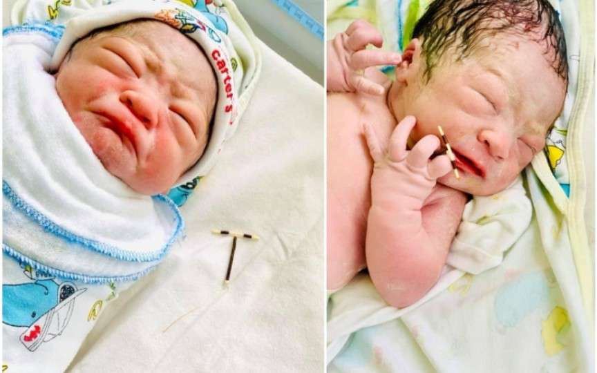 Un bebeluș s-a născut cu steriletul mamei în mână
