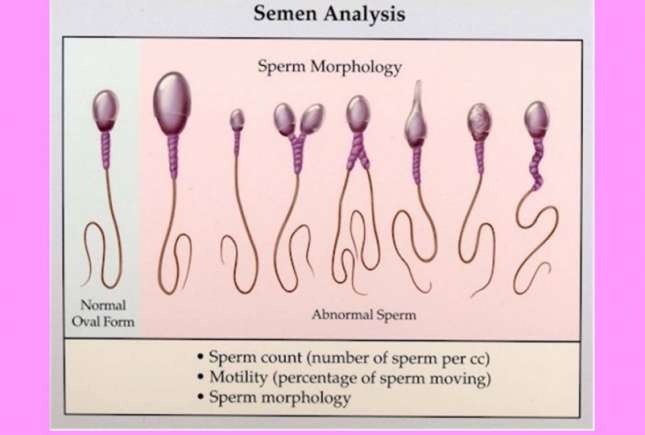 Specialist urologie-andrologie despre cele mai des întâlnite cauze ale infertilităţii la bărbaţi