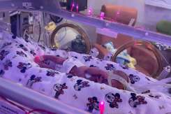 (FOTO) Un bebeluș prematur s-a născut având doar 425 de grame și mama l-a comparat cu un biscuit