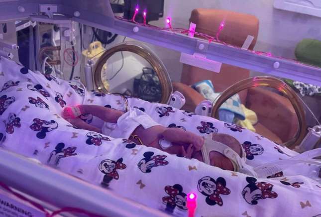 (FOTO) Un bebeluș prematur s-a născut având doar 425 de grame și mama l-a comparat cu un biscuit
